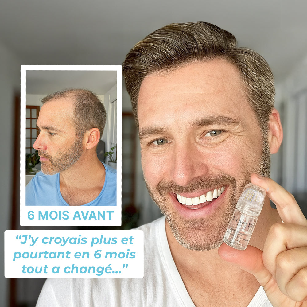 Kit Renouvellement Capillaire